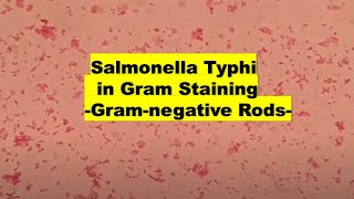 Salmonella Typhi in Gram stained smear of culture Microscopy at various magnifications [upl. by Reltuc170]