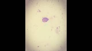 Giardia Lamblia trophozoite [upl. by Tristan407]