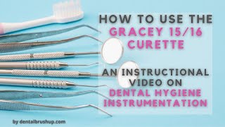 How to use the Gracey 1516 Curette [upl. by Enelram]