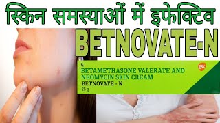 BETNOVATEN Cream Benefits and side effects in Hindi  Betamethasone Neomycin skin cream [upl. by Caiaphas]