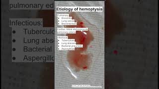 Etiology of hemoptysis [upl. by Allicsirp]