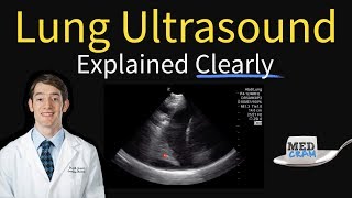 Lung Ultrasound Explained Point of Care Bedside Clinical [upl. by Enorahs446]