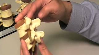 Degenerative Disc Disease Basic Terminology  Disc Herniations Osteophytes Stenosis [upl. by Mavilia]