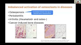 KRWebinar Intravital Imaging for monitoring osteoclast activity within hindlimb long bone [upl. by Flowers]