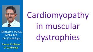 Cardiomyopathy in muscular dystrophies [upl. by Elimay]