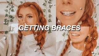 GETTING BRACES at 23 finally [upl. by Ailime]