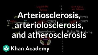 Arteriosclerosis arteriolosclerosis and atherosclerosis  Health amp Medicine  Khan Academy [upl. by Anaidiriv557]