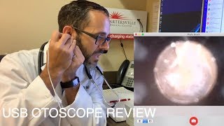 USB OTOSCOPE REVIEW  FOR MEDICAL PROVIDERS [upl. by Retsim]