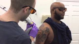 Does Tattoo Removal Hurt See Our Clients Reaction [upl. by Eicul]