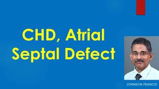 Atrial Septal Defect [upl. by Forlini277]