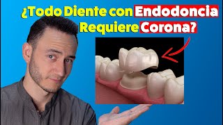 Si tienes Endodoncias necesitas Corona en esos dientes ¿Mito o realidad [upl. by Nama619]