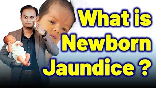 What is Newborn Jaundice or Physiological Neonatal Jaundice   Dr Bharadwaz  Treatment and Cure [upl. by Samson563]