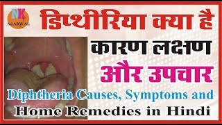 डिप्थेरिया क्या है कारण लक्षण और उपचार घरेलु उपायdiphtheria causes symptoms treatment [upl. by Akimad]