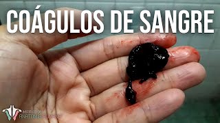 Lo que NECESITAS saber sobre los COÁGULOS DE SANGRE [upl. by Haneen736]