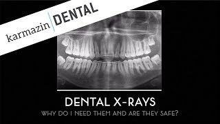 Dental XRays Are They Safe And Why Do You Need Them [upl. by Adne]