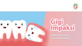 Gigi Impaksi Odontectomy atau Coronectomy  Impacted Teeth Odontectomy or Coronectomy [upl. by Nauqal]