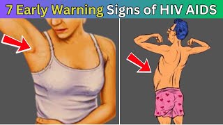 7 Warning signs of HIV  AIDS symptoms in Men  HIV symptoms in Men  HIV symptoms in Women [upl. by Eleda]