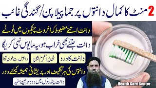 Teeth Pain Relief Home Remedy in UrduHindi  Teeth Pain Ka ilaj  Dr Sharafat Ali  Ahsan Cd [upl. by Beverly]