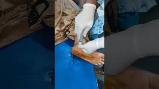 INTRAARTICULAR INJECTION FOR ANKLE PAIN [upl. by Elata]