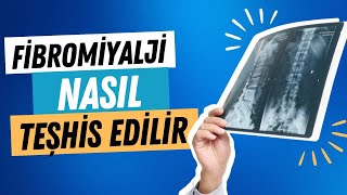 Fibromiyalji Nasıl Teşhis Edilir 🌿 [upl. by Dieball34]