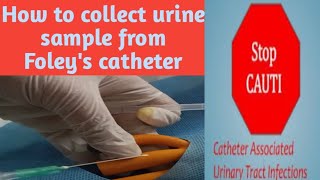 How to collect urine sample from Foleys catheterSample collection procedure2023nidhicreation2012 [upl. by Ailak483]