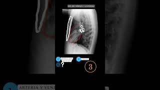 Radiografía de Tórax PA y Lateral  Anatomía de Tórax radiografía anatomía medicina shorts [upl. by Ahtamas]