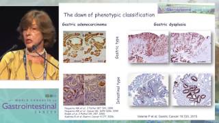 Gastric carcinogenesis of gastric cancer through the eyes of a pathologist [upl. by Silberman187]