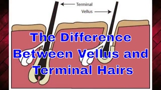 The Difference Between Vellus and Terminal Hairs  TheBeardnecessities  Ep 33 [upl. by Rosen117]