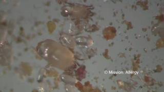 Dust Mites under the Microscope in HiDefmov [upl. by Asiela686]