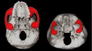 Starchild Skull For Dummies [upl. by Aerona]