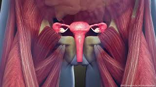 What is Intramural Uterine Fibroid Symptoms and Treatment  3D Guide [upl. by Ginni]