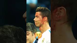 Anger after injury 🤕🤕🤕footballer ronaldo football cr7 messi realmadrid soccer viralvideo [upl. by Pryor256]