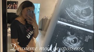 GROSSESSE mes symptômes du deuxième mois [upl. by Kriste174]