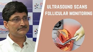 Everything about follicular tracking ultrasound scan  Ovulation tracking [upl. by Genevra]