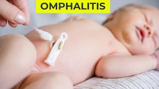 Omphalitis in Hindi  Neonatal Omphalitis  Nursinginnovationhindi [upl. by Analart]