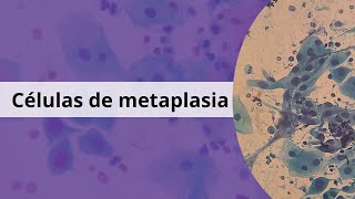 Metaplasia ¿Qué significa [upl. by Dulla937]