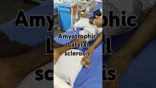 Amyotrophic lateral sclerosis motor neuron disease [upl. by Shelba]