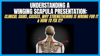 Winging Scapula Clinical Presentations amp Why It Isn’t A Serratus Anterior Problem [upl. by Euf610]