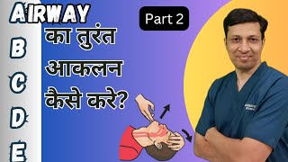 गंभीर मरीज में airway का आकलन कैसे करे  Airway assessment and management [upl. by Xenia]