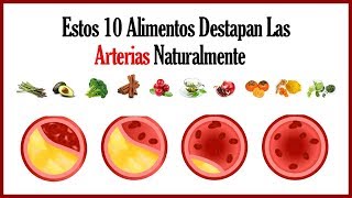 Cómo Limpiar Las Arterias Del Corazón De Forma Natural  10 Alimentos Para Limpiar Las Arterias [upl. by Yalcrab112]