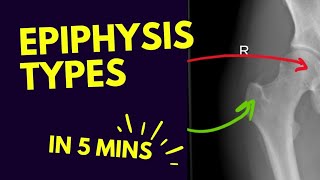 Types of Epiphysis  In FIVE 5️⃣ Minutes [upl. by Llerral]