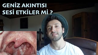 Geniz Akıntısı Sesi Etkiler mi [upl. by Ykroc]