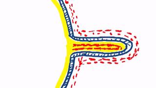 chorionic villi by dr sameh ghazy [upl. by Marin]