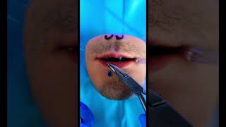 Saddest Emergency Fruit Surgery of all time will make you cry Realistic CSection by Fleeting Films [upl. by Burgener631]