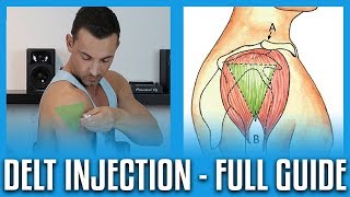 How To Do A Deltoid Injection  Full GuideDemo [upl. by Neeham959]