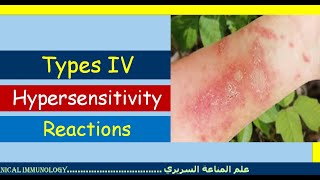 Lecture 7 Type IV Hypersensitivity Reaction [upl. by Ydnim]