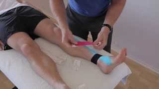 How to treat Anterior Shin Splints with Kinesiology taping [upl. by Aikaz]