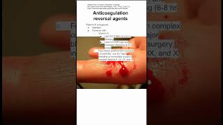 Anticoagulation reversal agents [upl. by Nelubez874]