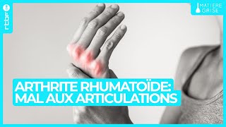 Arthrite rhumatoïde  avoir mal aux articulations nest pas quune question dâge  Matière Grise [upl. by Womack266]