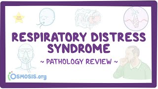 Respiratory distress syndrome Pathology Review [upl. by Eniruam81]